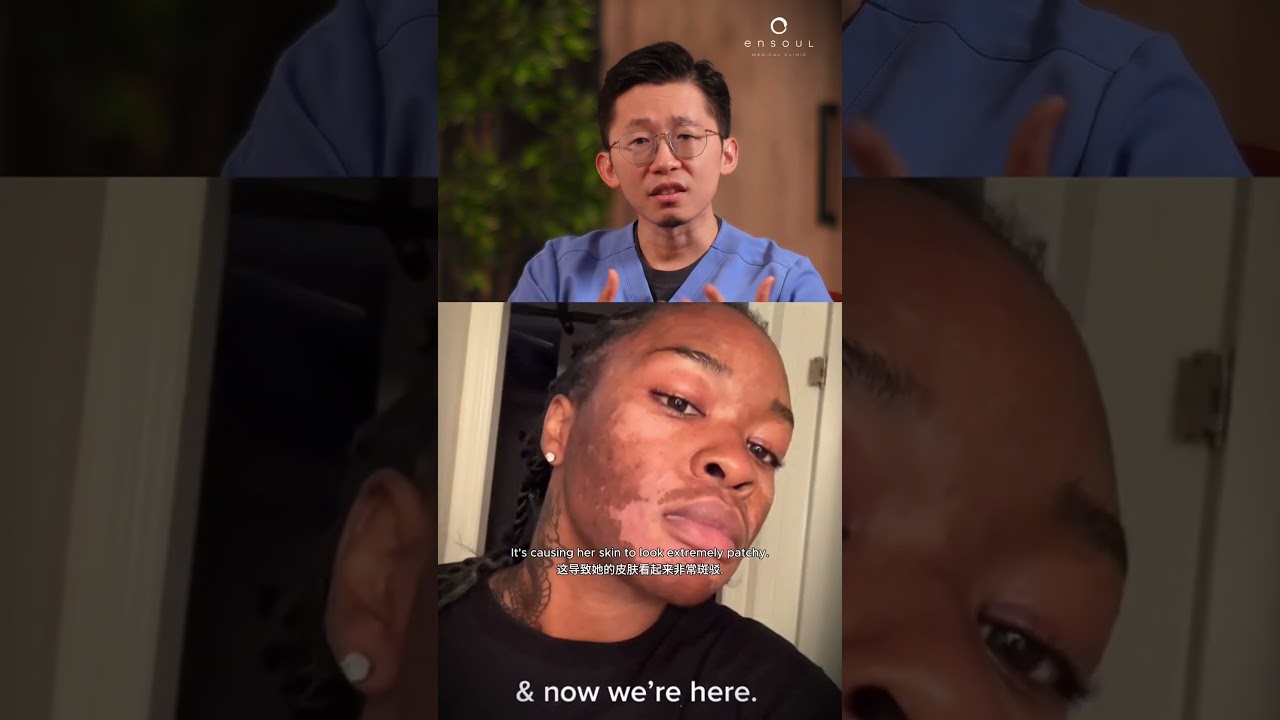 What Should You Do When You Have Pigmentation? 😱#hyperpigmentation #topicalcream #beautyfails