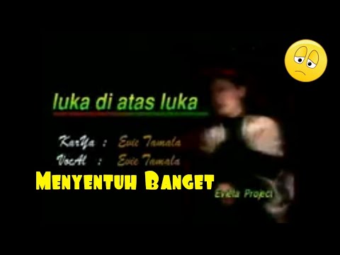 Mp3 tunggu luka disini Mp3 tunggu luka disini