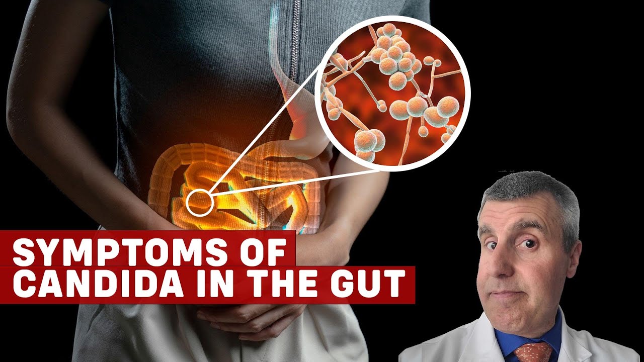 Candida Overgrowth Symptoms