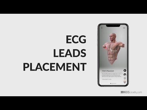 12 lead ECG lead placement - App