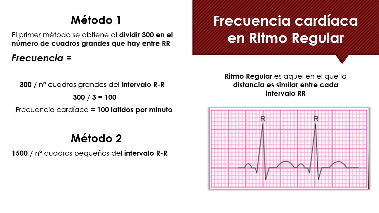 Determinación Frecuencia Cardíaca en ECG