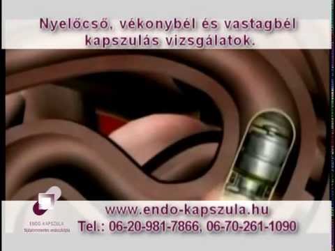 Zsírbontó kezelések – Mi a különbség közöttük?