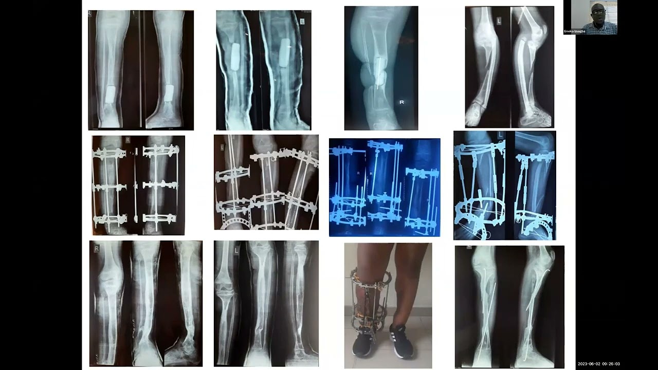 Session 07: Lessons Learned From Across the Globe Nigeria