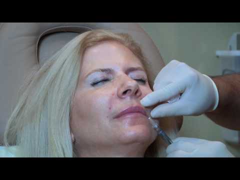 Fuller Lips - Pouty Lip Look - Lip Augmentation