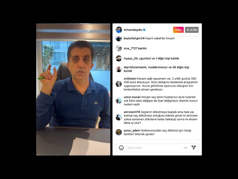 Saç Ekiminde 2. Seans ve Sizden Gelen Soruları Yanıtladım - Dr. Hamid AYDIN