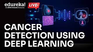 Cancer Detection using Deep Learning | Deep Learning Projects | DL Training | Edureka Live