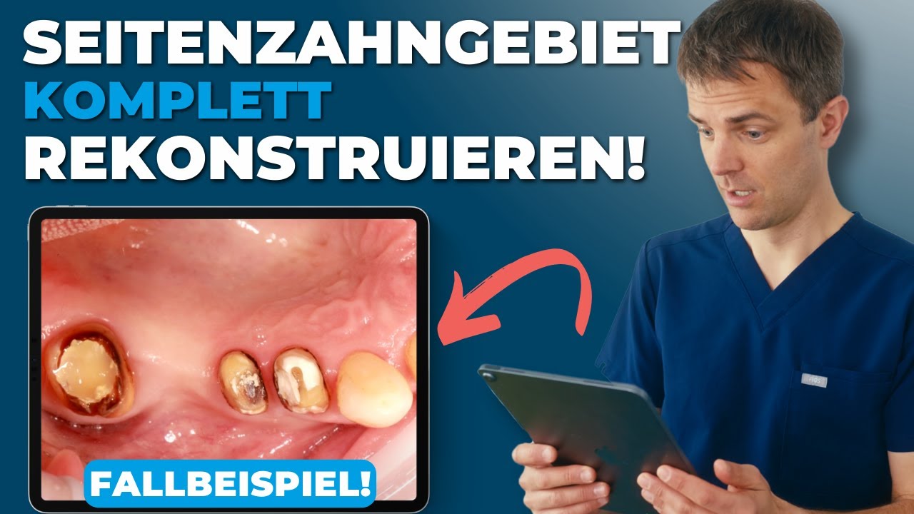 Video-Vorschaubild