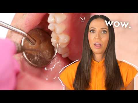 Do These 5 Things to Wow Your Dentist at Every Checkup