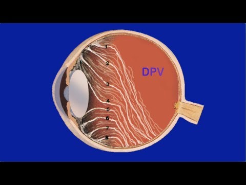 Présentation sur les premiers secours en cas de crise hypertensive Médicaments de choix pour lhypertension