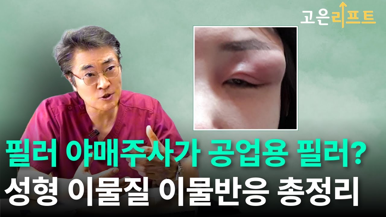 고은리프트 이물질제거 필러부작용 유튜브 영상