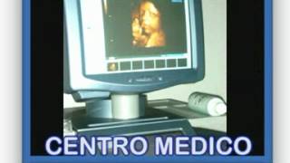 preview picture of video 'CENTRO MEDICO POLISPECIALISTICO LA BETULLA MONTE DI MALO (VICENZA)'