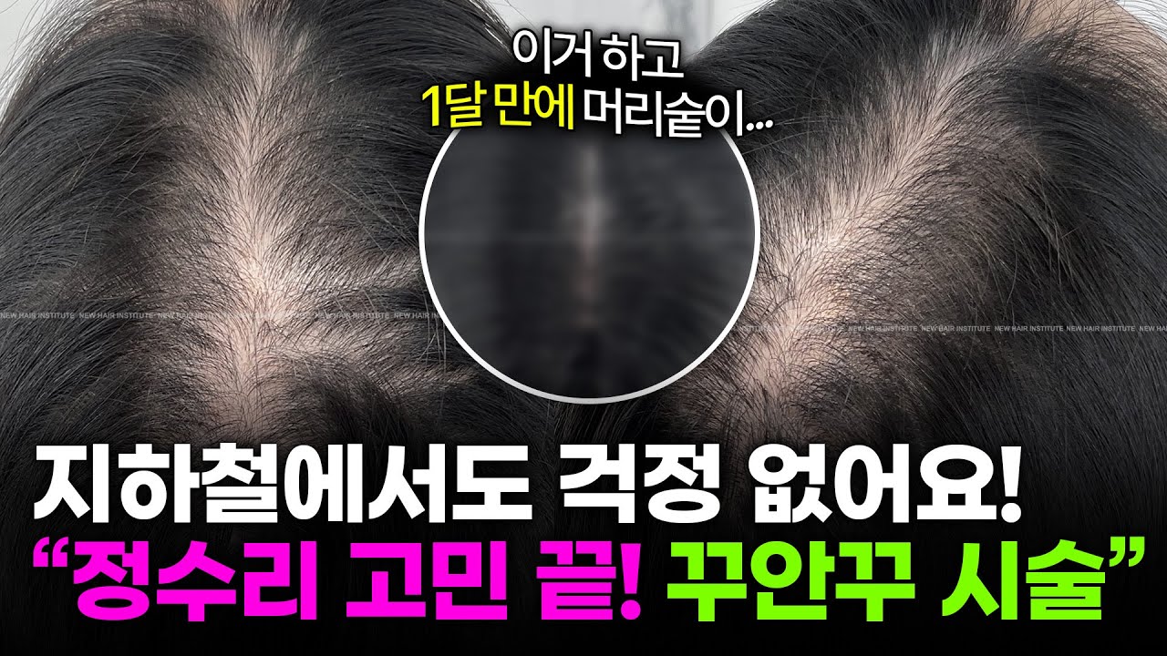 머리문신, 두피문신이 만족도 높은 미용시술인 이유 l 20~60대 여성 시술 모음집