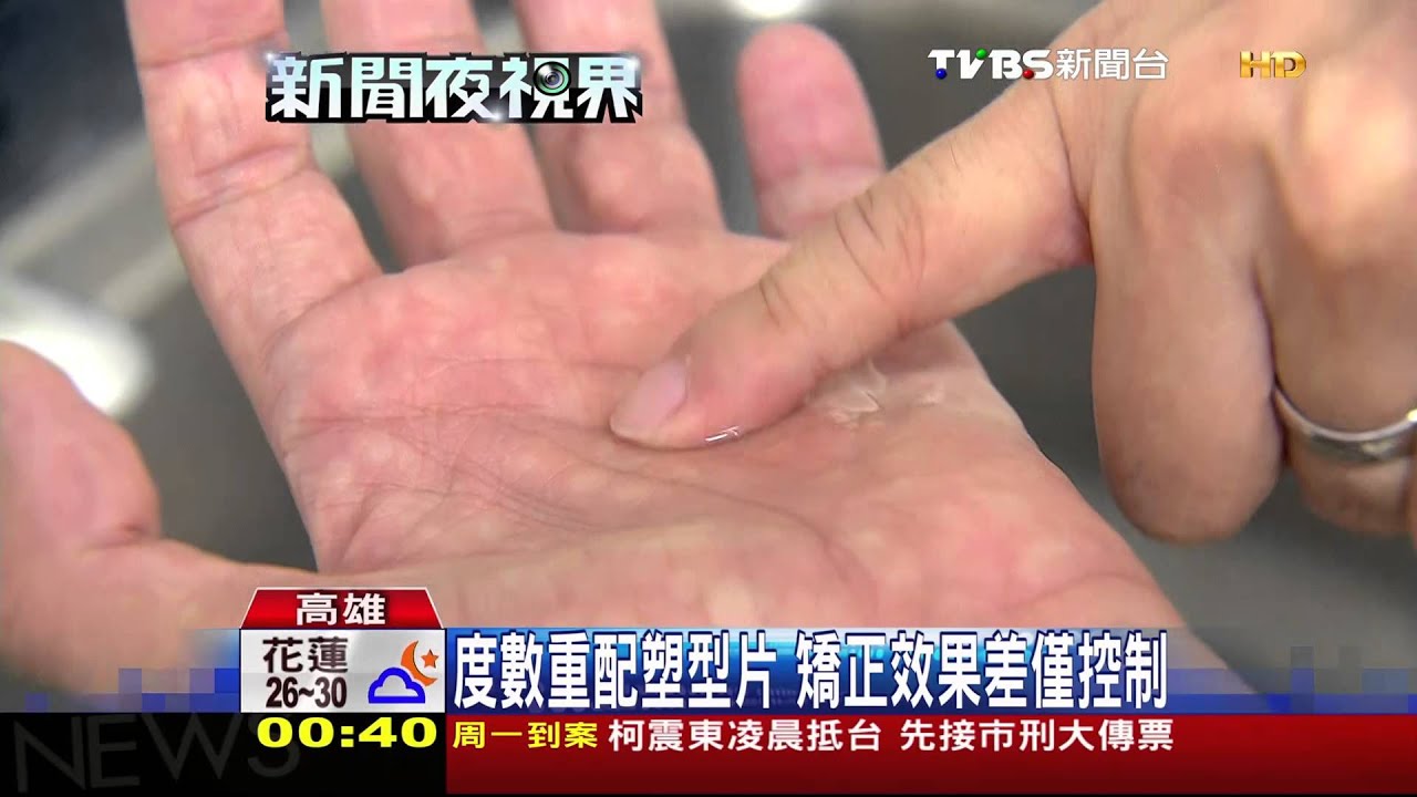 角膜塑型術矯正近視　18歲前效果佳
