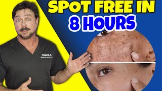 Your Age Spots Don't Stand a Chance Against This!