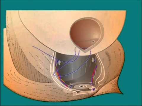 Prostata-Massage zu Hause Pflegeprozess mit Prostatakrebs
