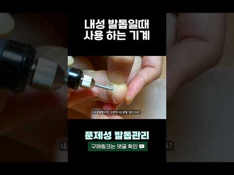 내성발톱자가치료 동영상 미리보기