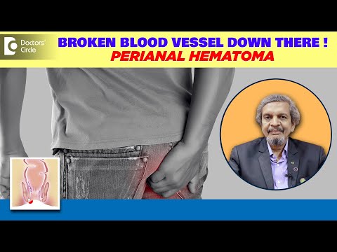 Bleeding From Anus /Burst Blood Vessel from Below |Piles Bleeding-Dr.Rajasekhar M R| Doctors' Circle