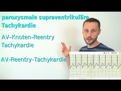 Die supraventrikuläre Tachykardie! AV-Knoten-Reentry und AV-Reentry-Tachykardie