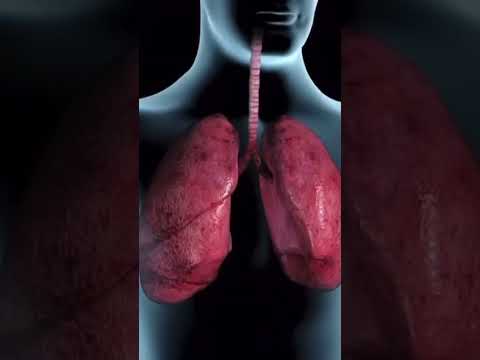 Tuberculosis (TB) Symptoms #symptoms #tb