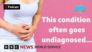 Will renaming PCOS help women get diagnosed? - What in the World podcast, BBC World Service