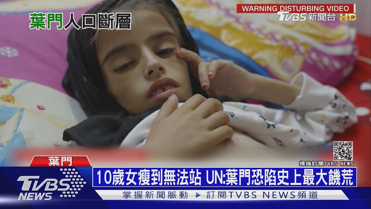 10歲女孩瘦到無法站! 葉門40萬童恐死於饑荒