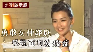 [問題] 想順利當完四個月的兵 怕被驗退