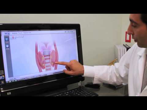 video:Minimally Invasive Parathyroid Surgery | Babak Larian, MD, FACS