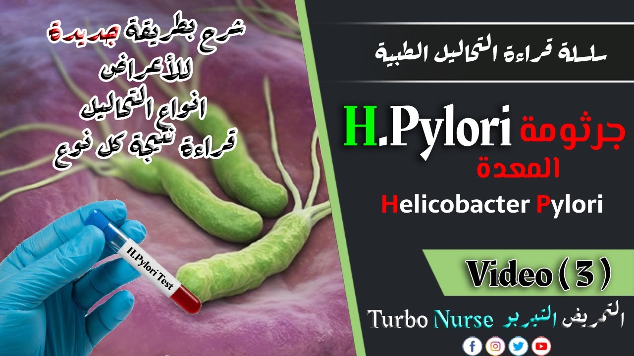 كيفية قراءة نتيجة تحليل جرثومة المعدة | تحليل H Pylori اعراض جرثومة المعدة