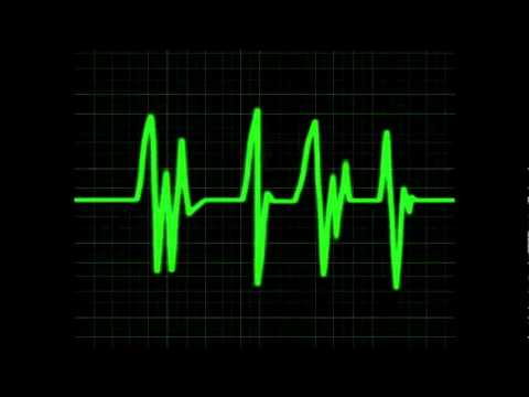 Iguan & Maxi K - Palliative Musik [Beat Universal Sawyer] Rap Fr