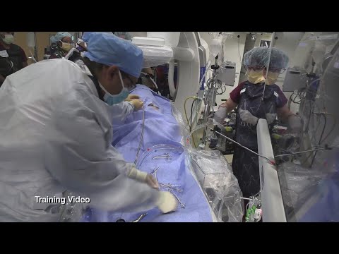 University of Iowa Hospitals unveil eCPR, new process for saving cardiac patients