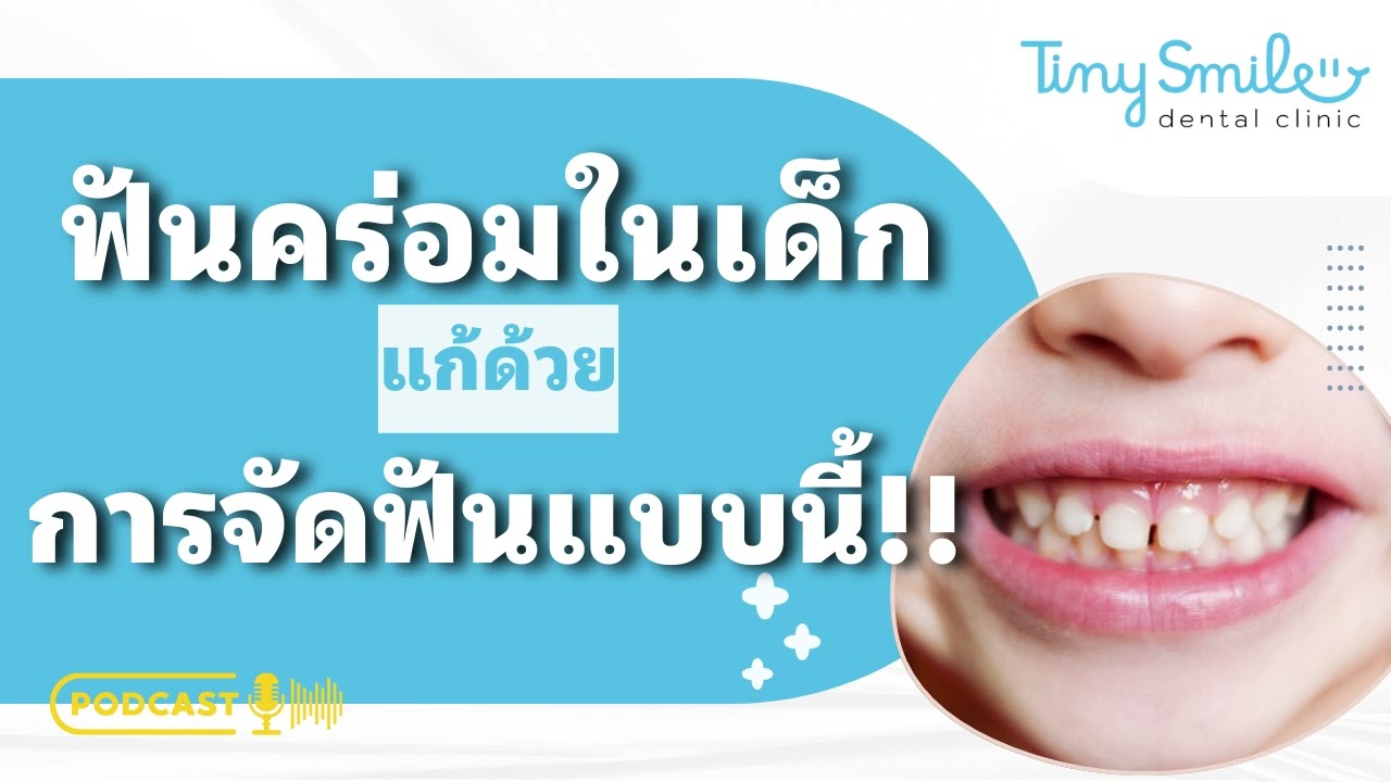 ฟันคร่อมในเด็ก แก้ด้วยการจัดฟันแบบนี้ | Tiny Smile Podcast