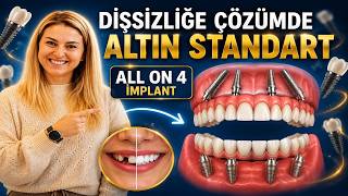 Total Dişsizliğe Standart Çözüm: All-On Four