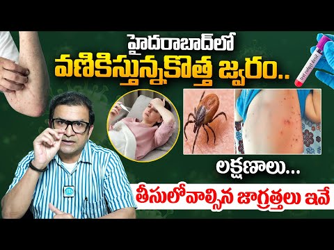 హైదరాబాద్ లో కొత్త జ్వరం..| New Fever in Hyderabad |Scrub Typhus Disease Symptoms |Dr Movva Srinivas