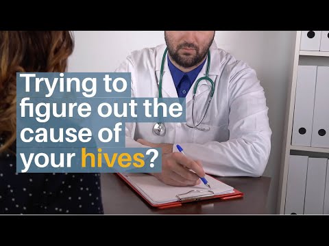 Pinpointing the Cause of Hives