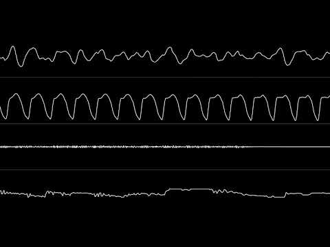 Jogeir Liljedahl - “Addiction” (Amiga MOD) [Oscilloscope View]