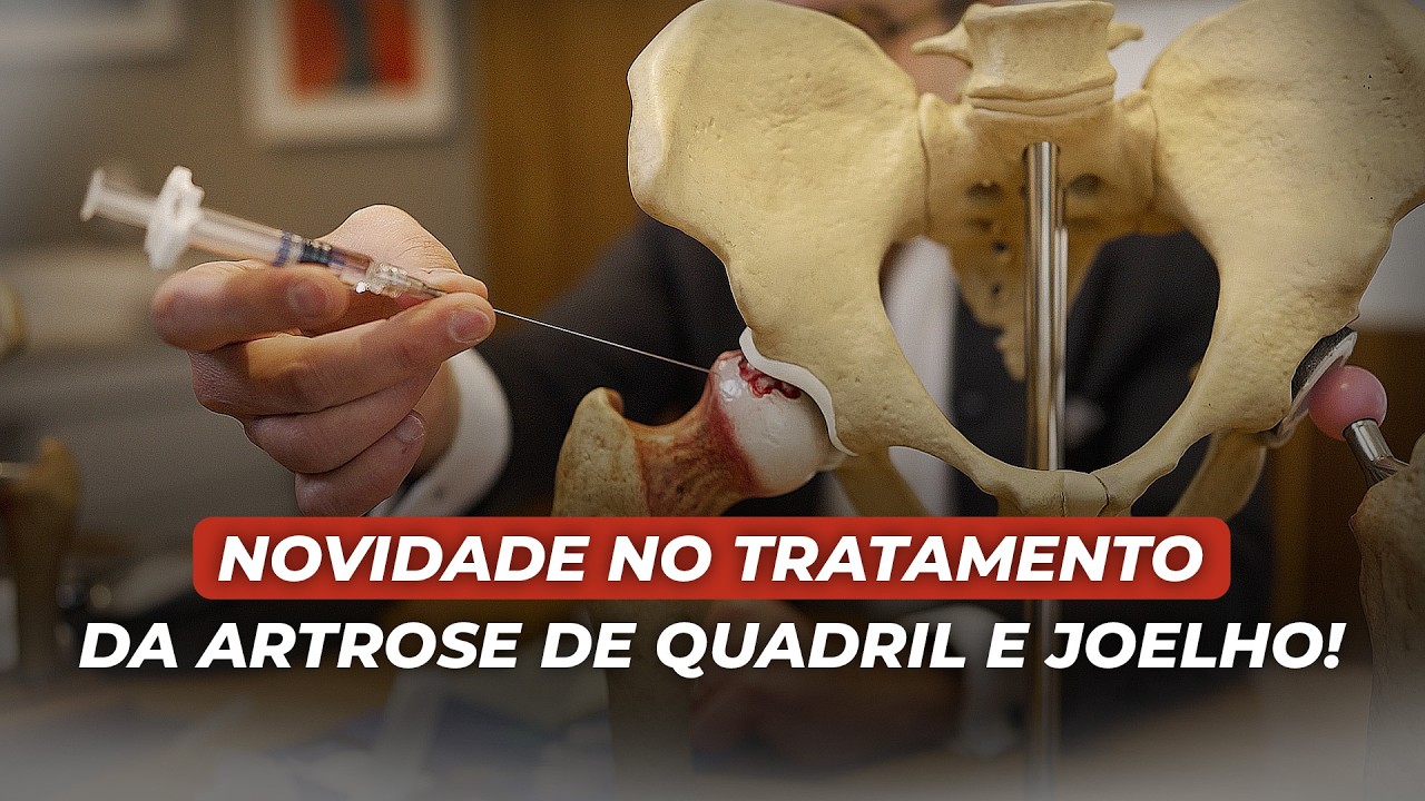 New treatment for osteoarthritis without surgery has arrived in Brazil | Discover Bioactive Hydrogel