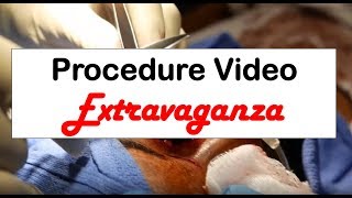 An Hour Long Extravaganza of Emergency Procedure Videos