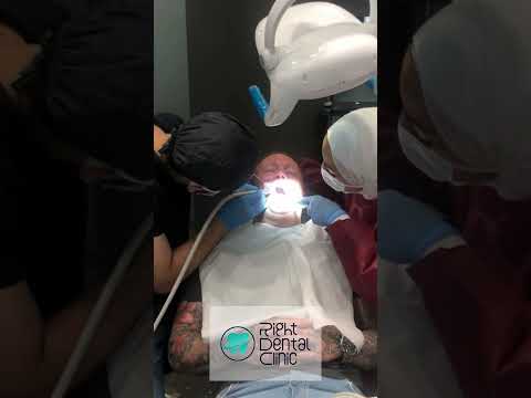 result #dentalclinic #smiledentist #dentist #gorgeoussmilesdentist #smilemakeover #dentalexc