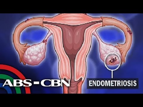 Tea Turboslim mula Evalar review Mawalan ng 40 kg bago at pagkatapos ng mga larawan