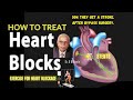 How To Treat Heart Blockages Dr B M Hegde