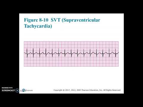 Cardiac Chapter 8 Video 7