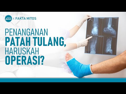 Cara Dokter Ortopedi Menangani Patah Tulang, Belum Tentu Operasi! | Hidup Sehat tvOne