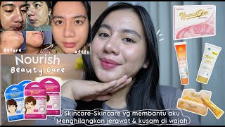 Download lagu HONEST REVIEW OF RESULTS FROM NOURISH SKIN AND USE OF NOURISH ACNE SERIES mp3