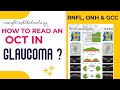 HOW TO READ AN OCT PRINTOUT IN GLAUCOMA || STEPWISE || EXTREMELY EASY || PART -2
