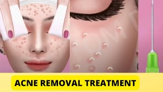 how to remove scars from face permanently | how to get rid of acne scars in a week