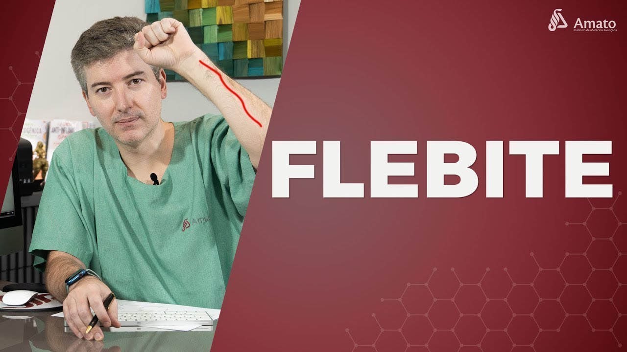 FLEBITE: Tudo o que Você Precisa Saber Sobre