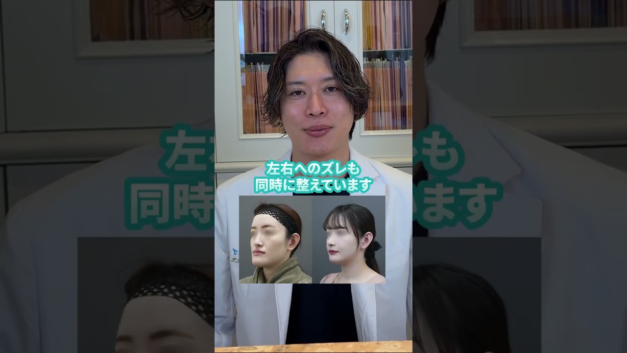 【質問回答】何センチ切った？