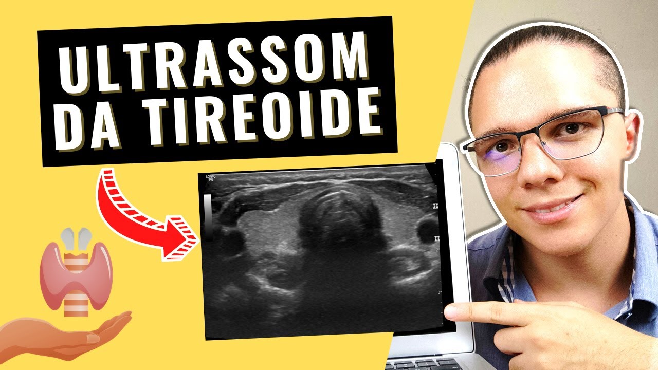 ULTRASSOM DA TIREOIDE COM DOPPLER: como este EXAME de ULTRASSONOGRAFIA é feito e para que serve?