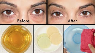 How to Get Rid of Puffy Eyes, Swollen Eyelids & Dark Circles