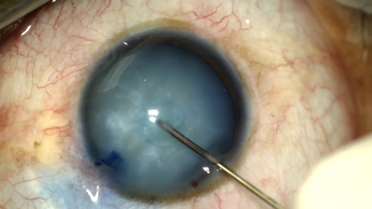 Marco Aurelio Hernández García-32